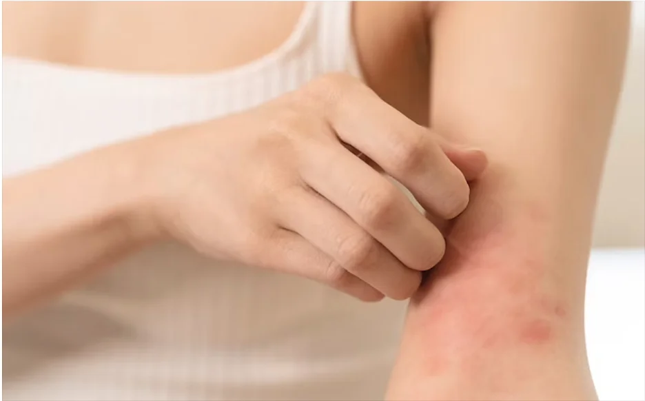 Project Scratch: Unlocking the Gut-Skin Axis