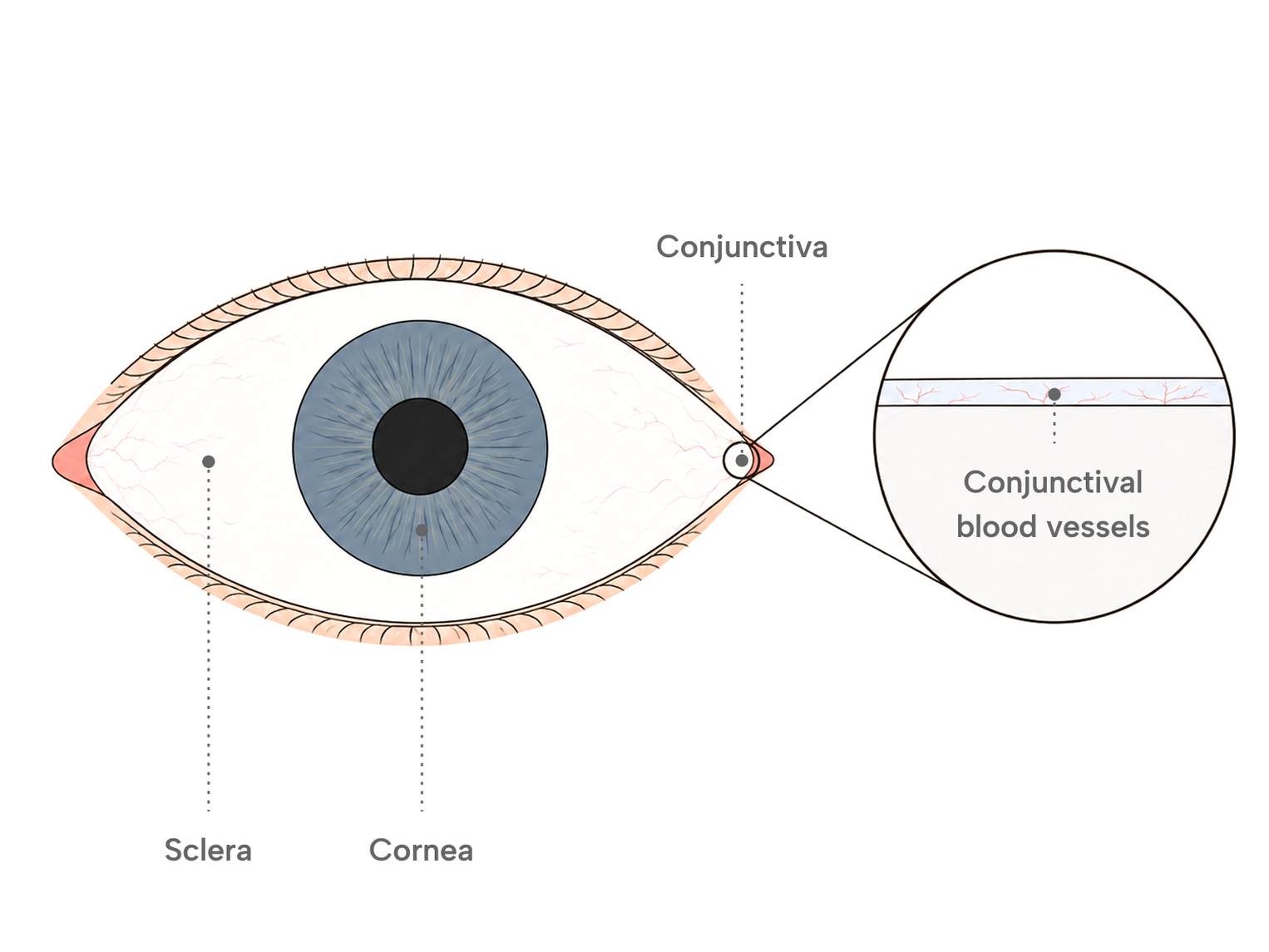 Diagram of the front of an eye labelling the sclera, cornea and conjunctiva, with an inset showing conjunctival blood vessels in a thin layer over the white.