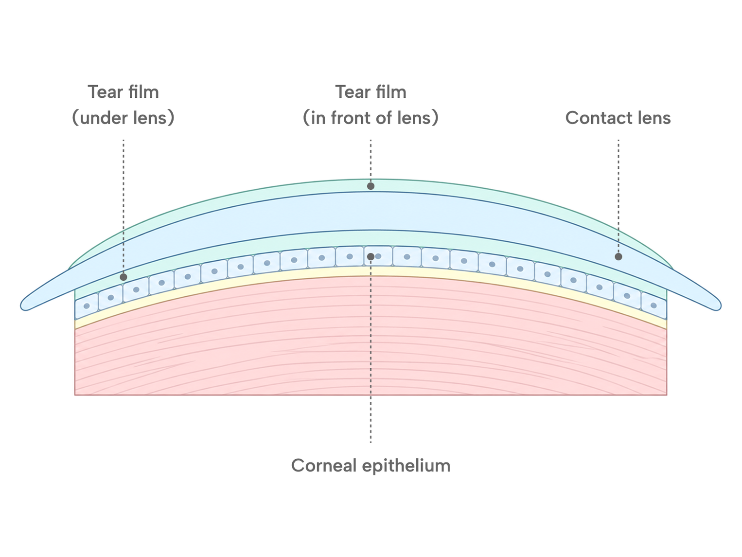 Cross-section diagram of a contact lens resting on the corneal epithelium, labelling the tear film in front of the lens and the tear film under the lens.
