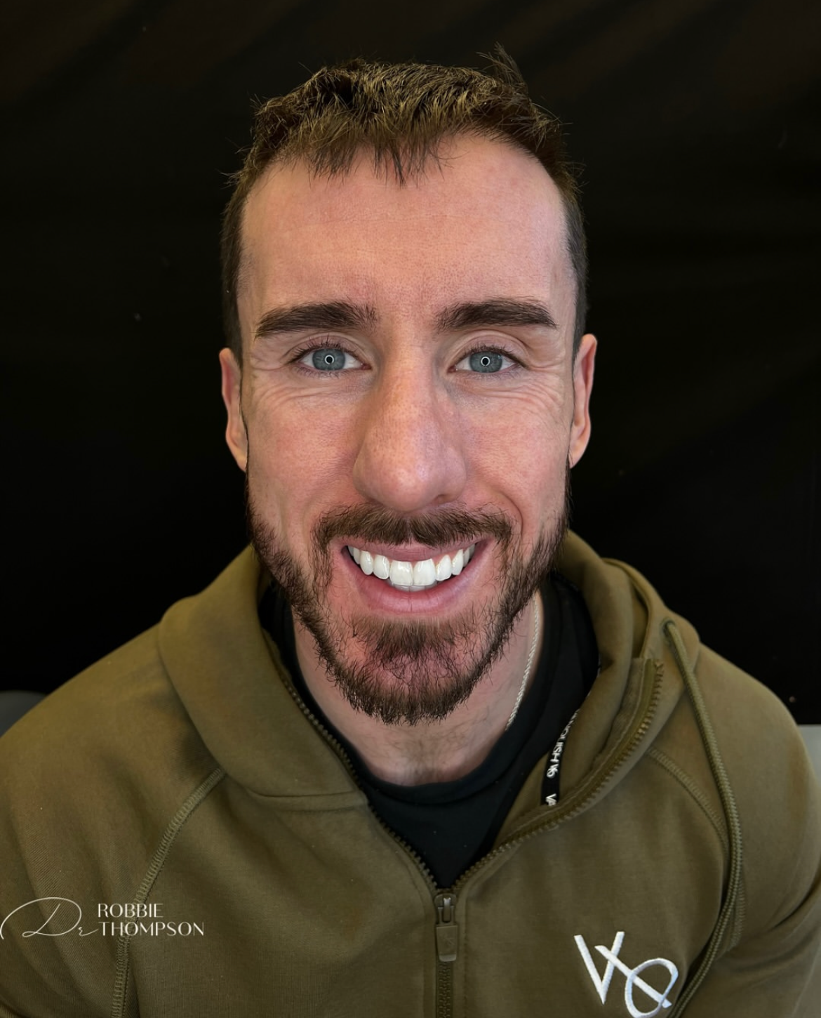 After results for patient who had invisalign, whitening and crown lengthening by Robbie Thompson