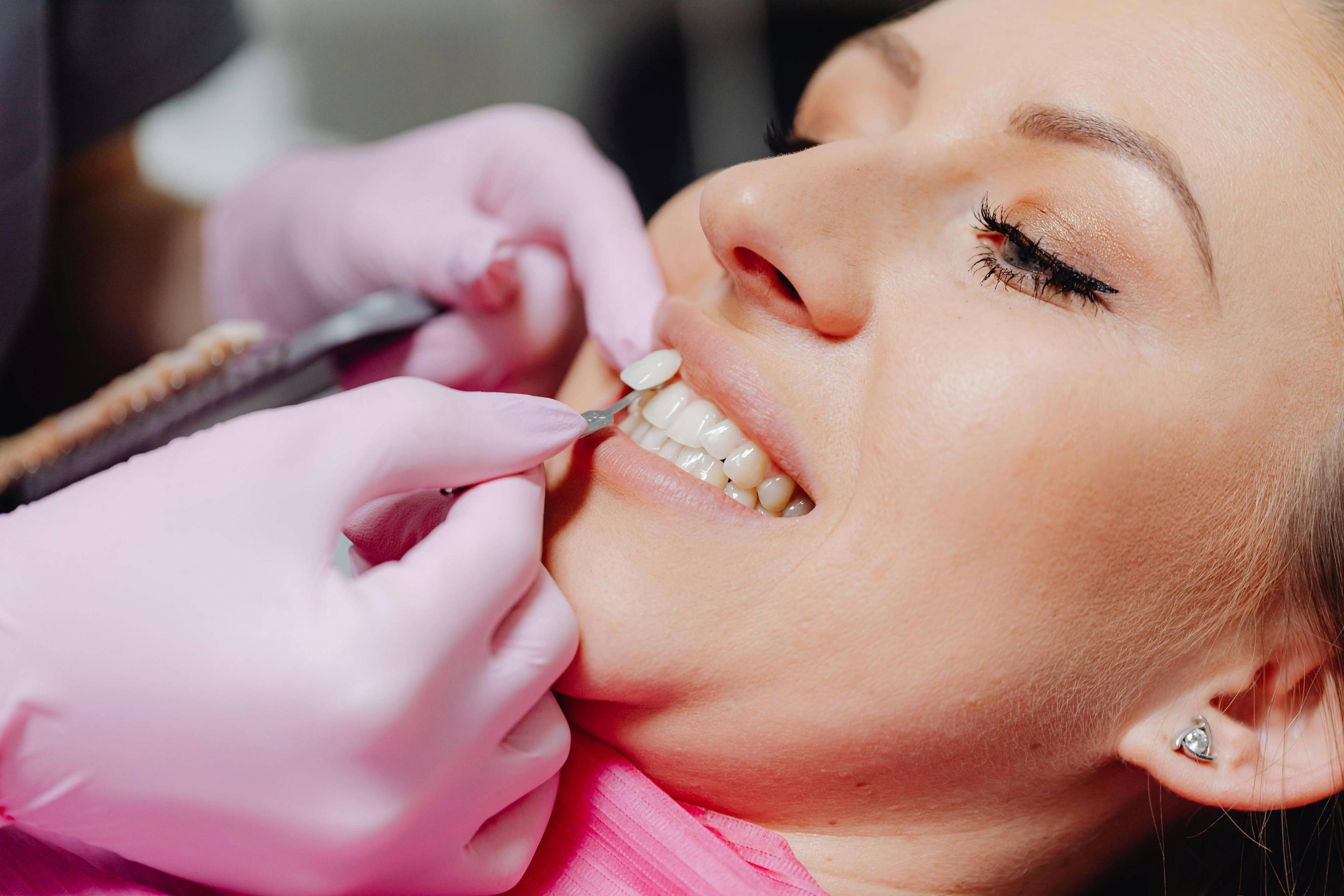 Patient comparing tooth shades during a cosmetic dentistry consultation at Bath Spa Dentistry.