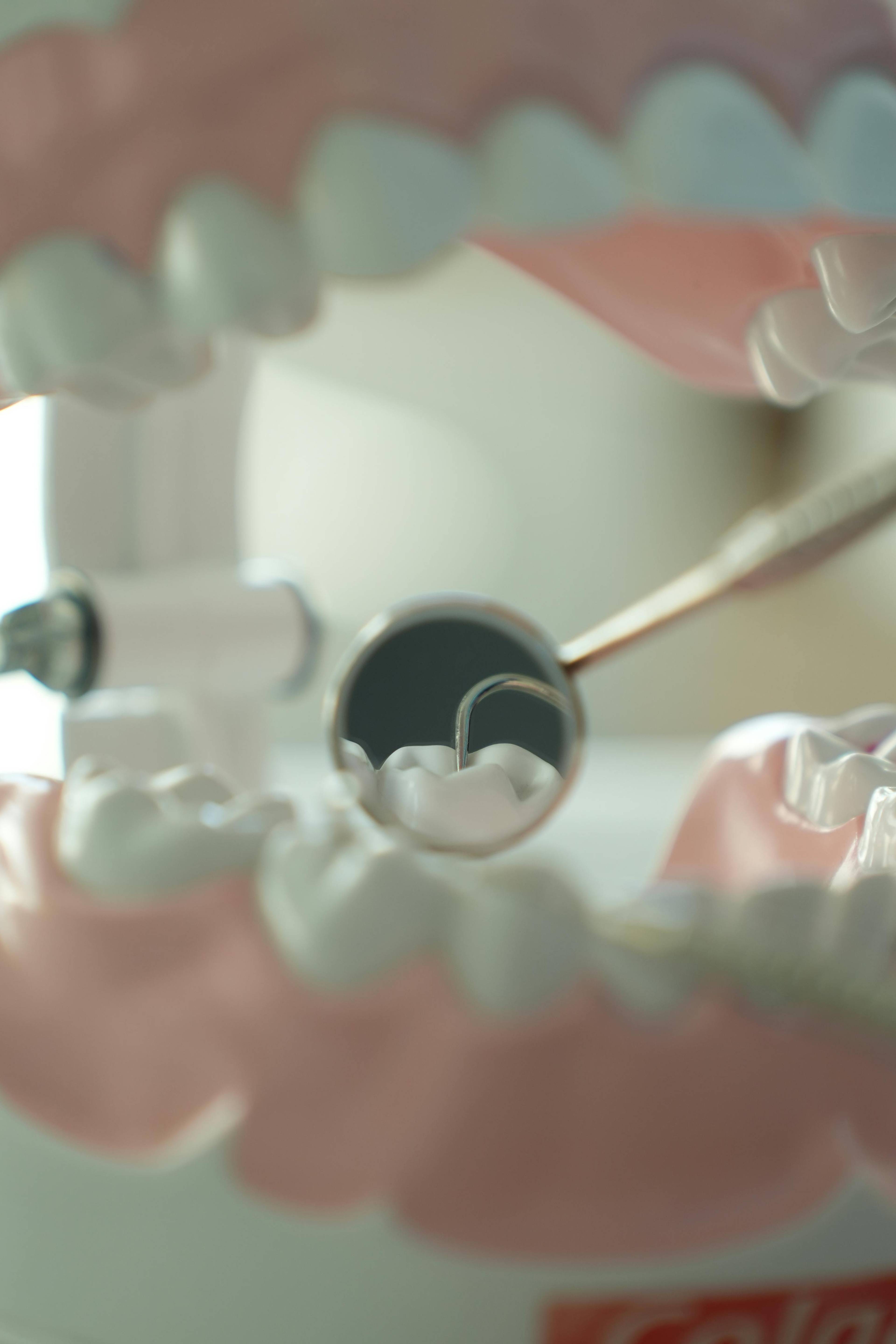 Dental mirror and explorer instrument positioned between dental models to demonstrate oral examinations and preventive dental care at Bath Spa Dentistry.