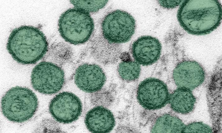 Source : CDC / Cynthia Goldsmith – Public Health Image Library (public domain)