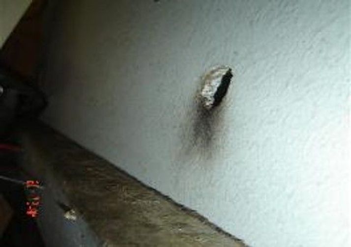 segni di sfregamento sul grasso addominale