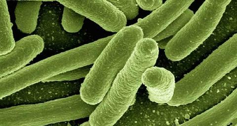 trattamento legionella