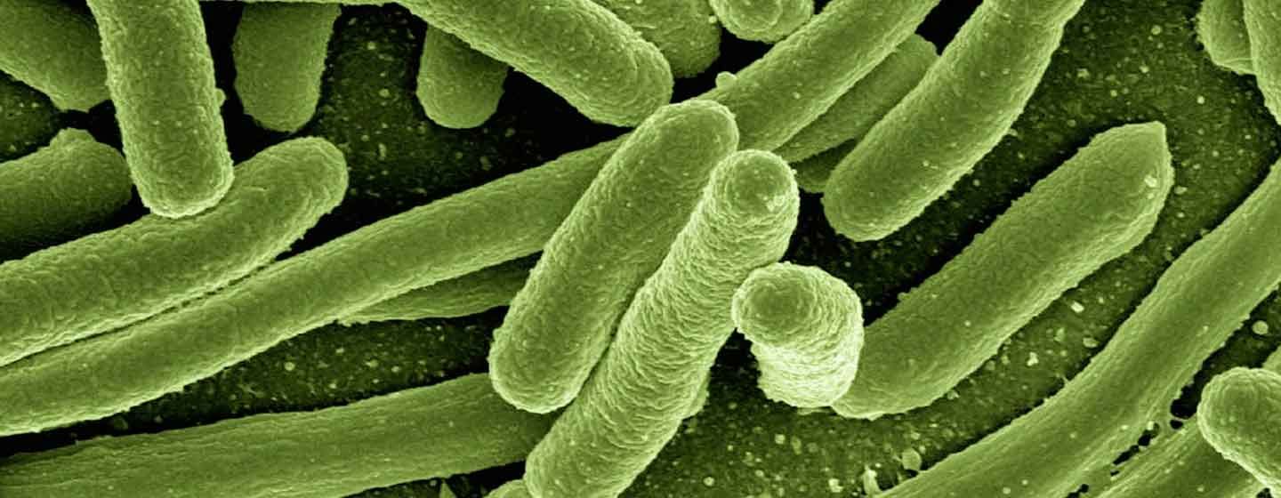tratamiento-legionella