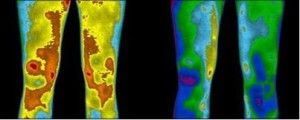 earthing thermal image
