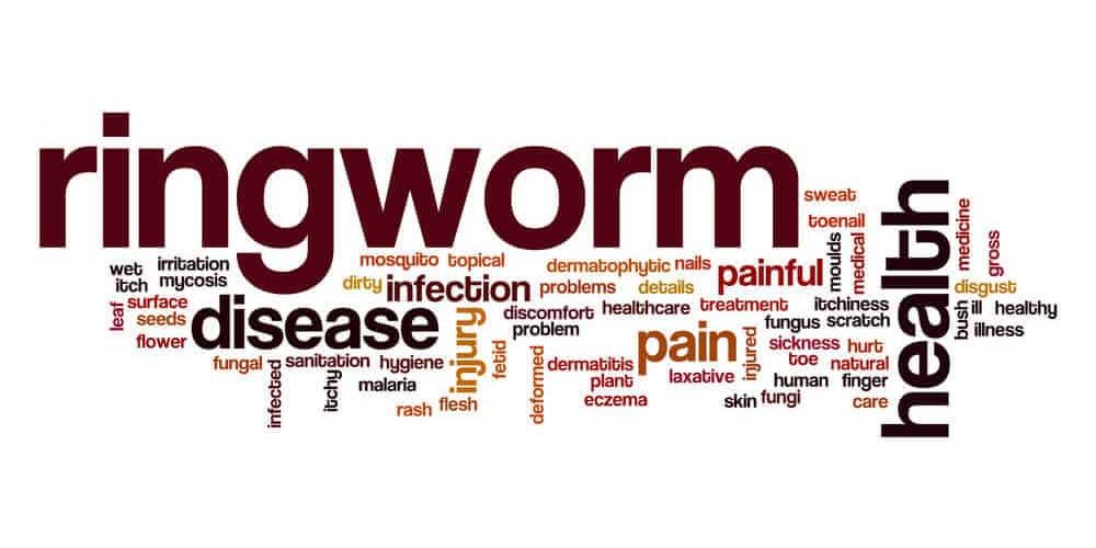 Natural Remedies for Getting Rid of Ringworm