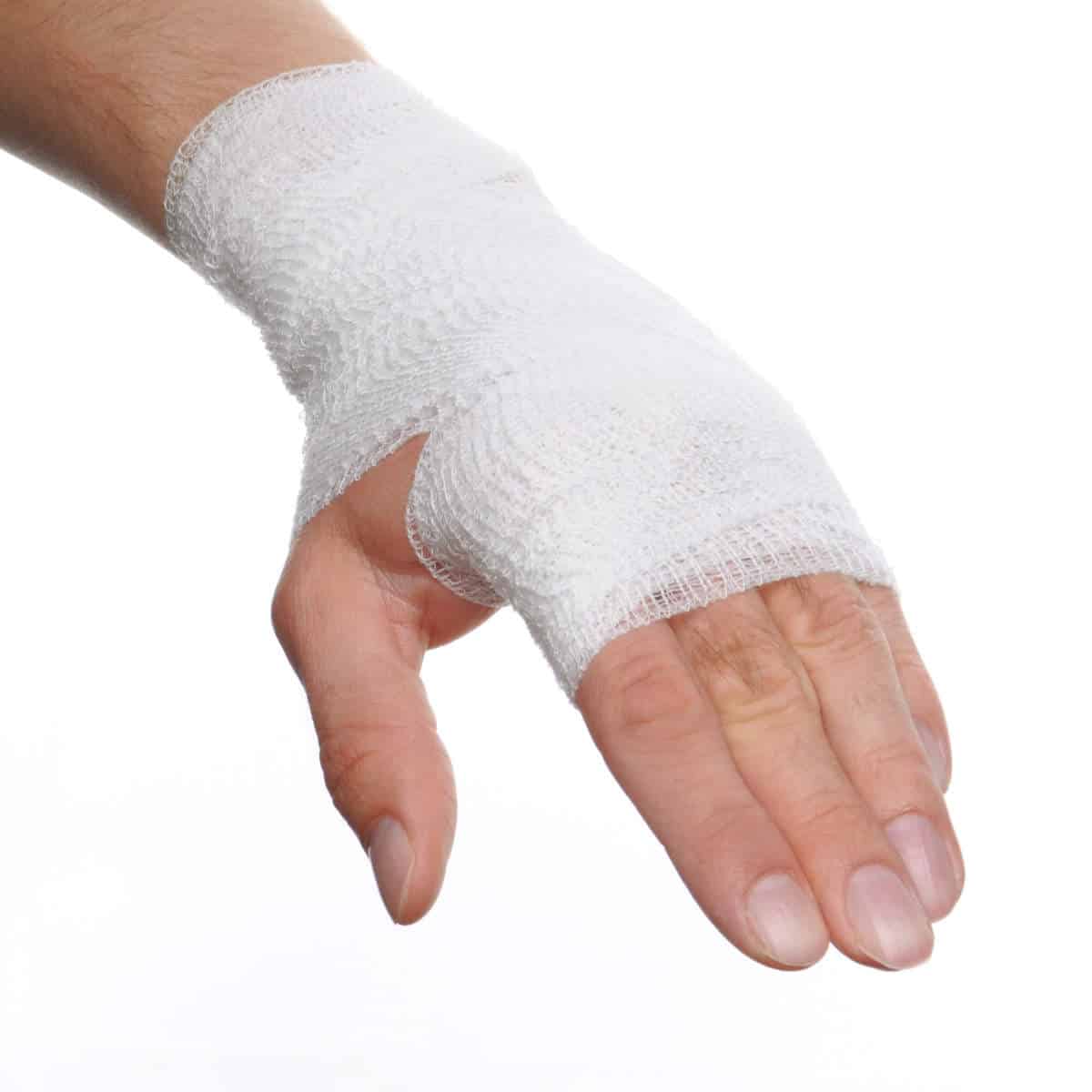 Wound on hand
