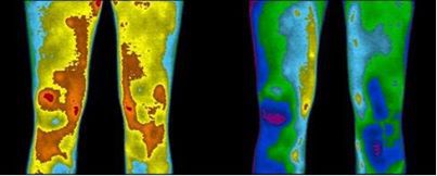 Earthing Thermal Image