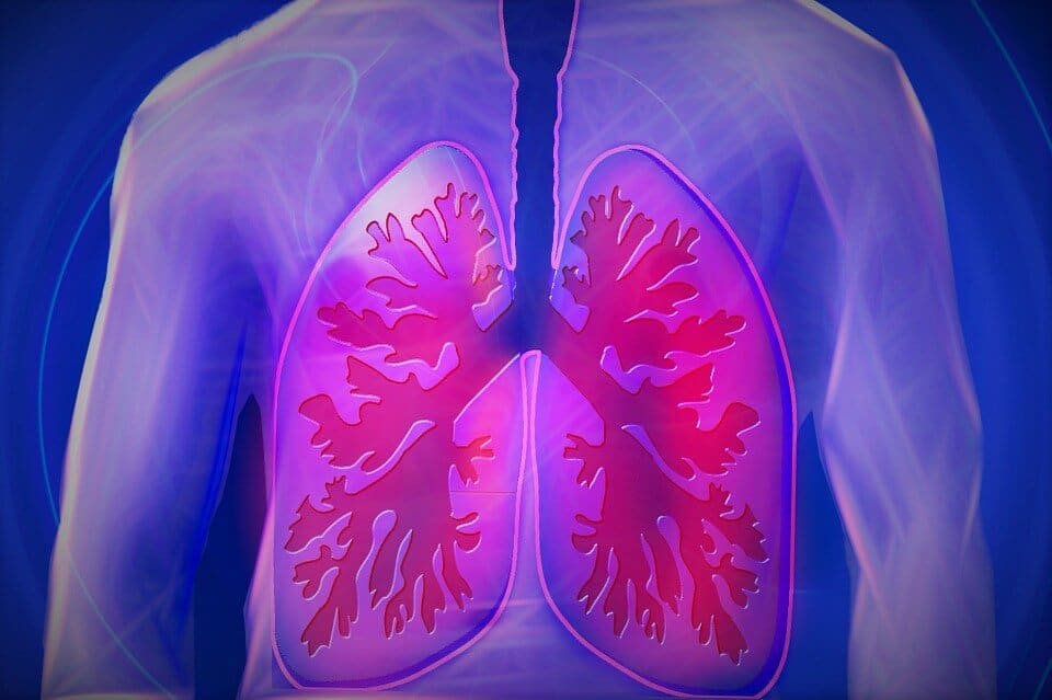 Lung Cancer