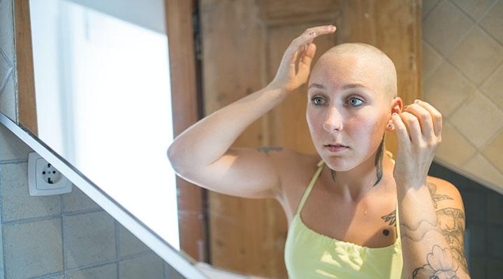 Everything You Need to Know about Hair Loss from Chemotherapy