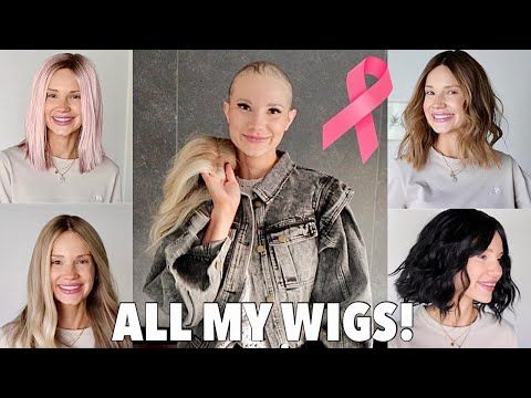 Dylan & Delia Chatwin: Hair Loss & Wigs | I Lost All Of My Hair To