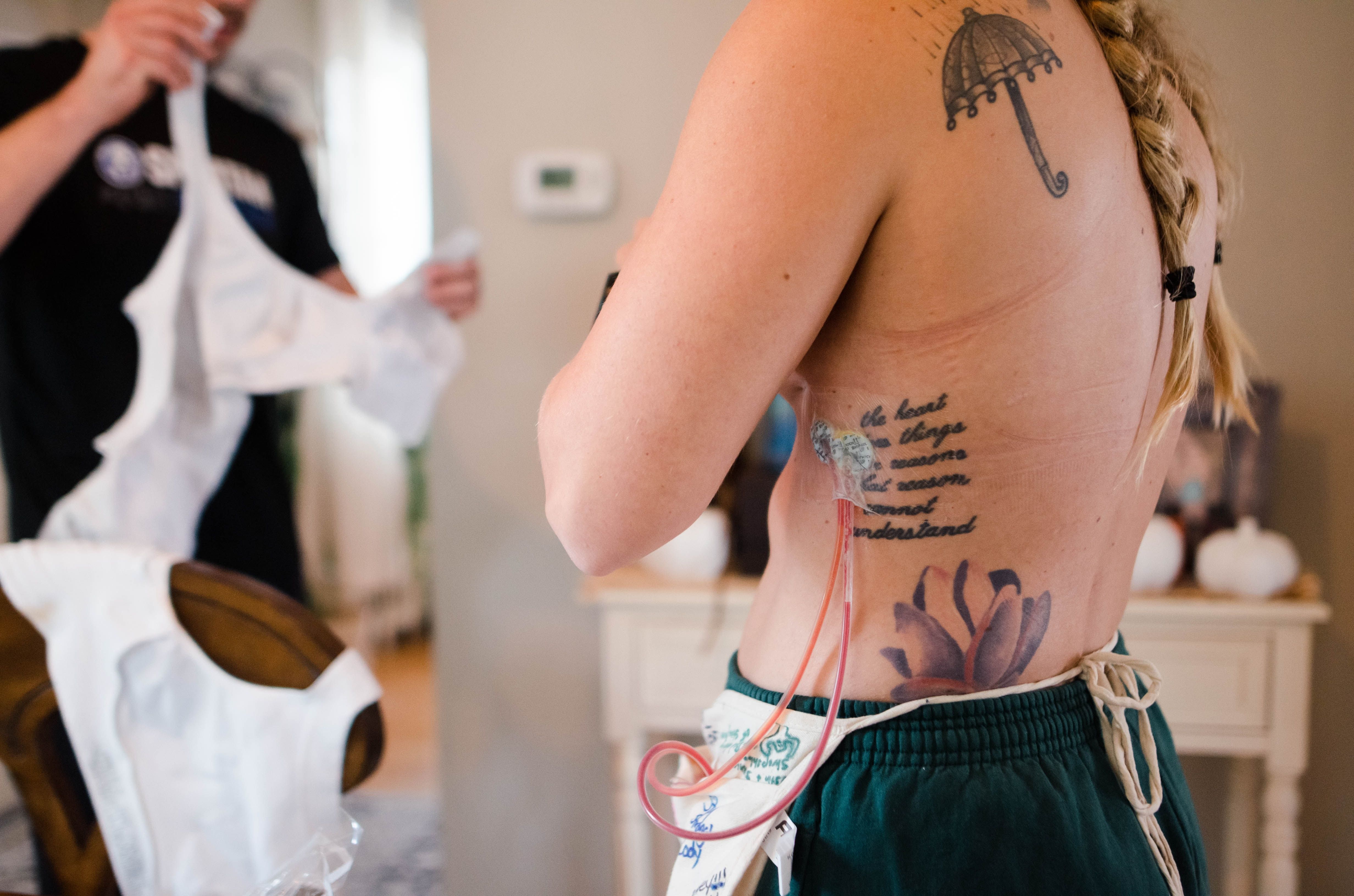 Moving Between Grief and Gratitude After a Mastectomy