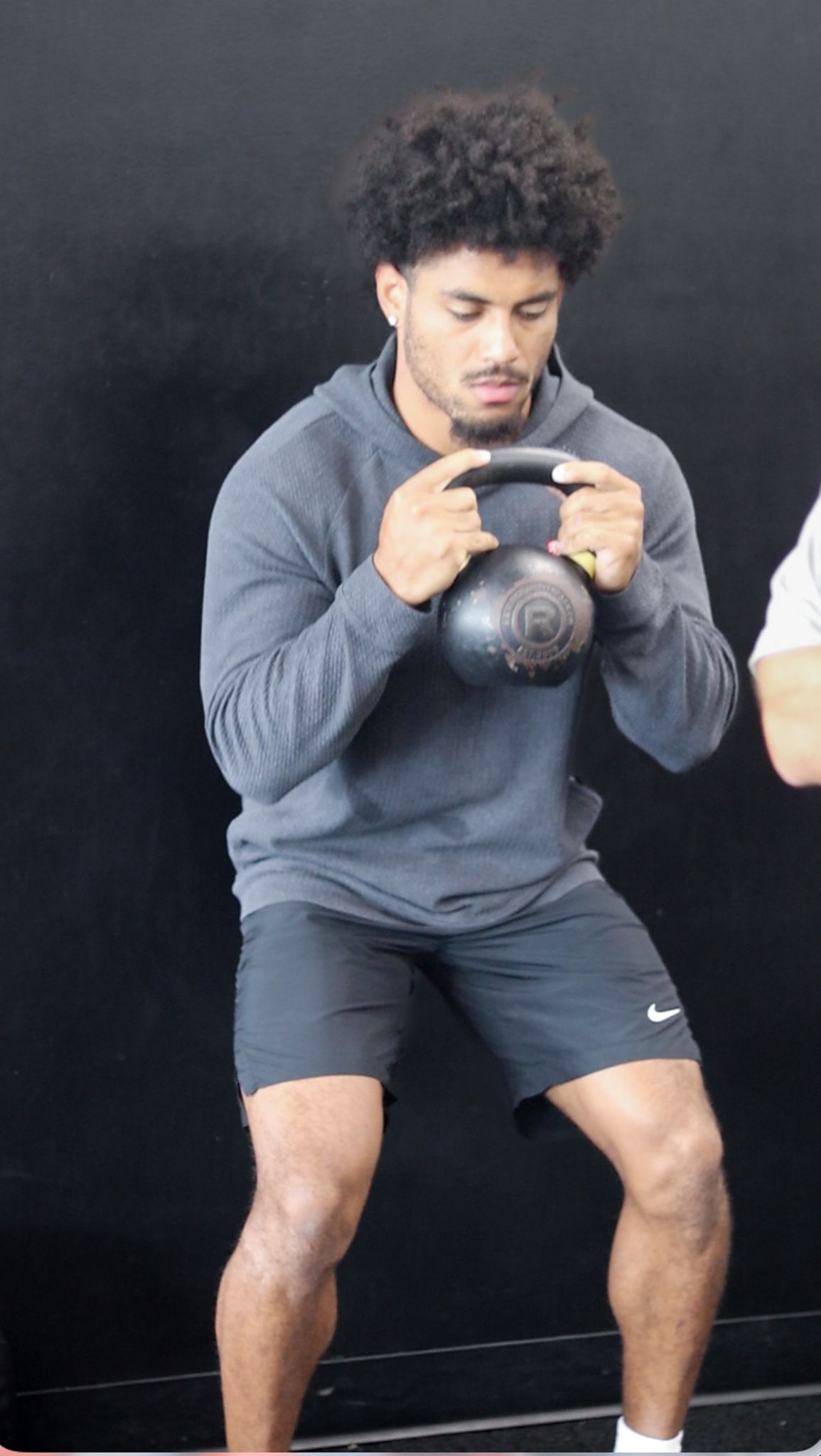 Managing Acute Low Back Pain Ahead of an NFL Tryout