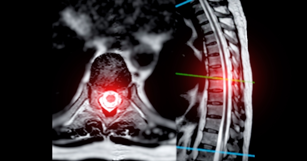 Image Catastrophic Injury Attorneys NJ