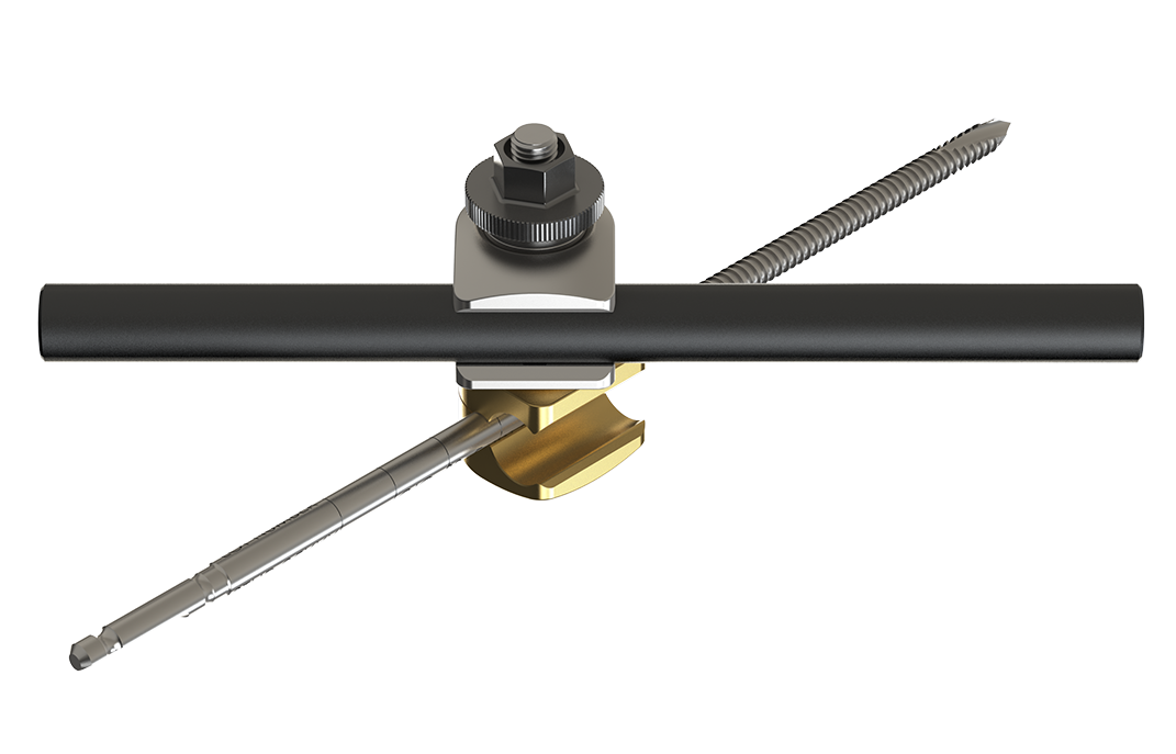 External Fixation