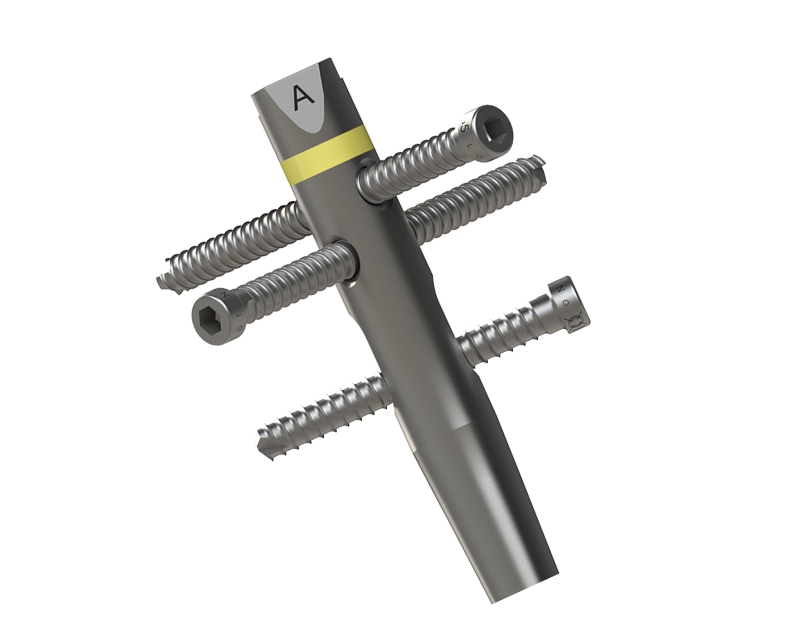 Tibial Nail