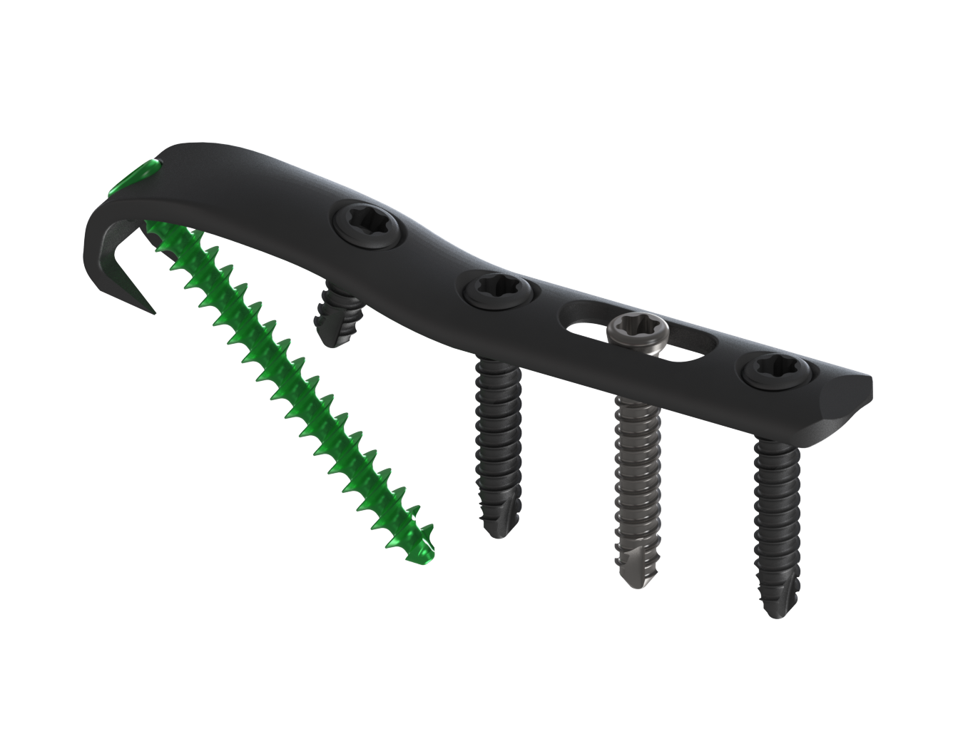 ANKx Ankle Fixation System