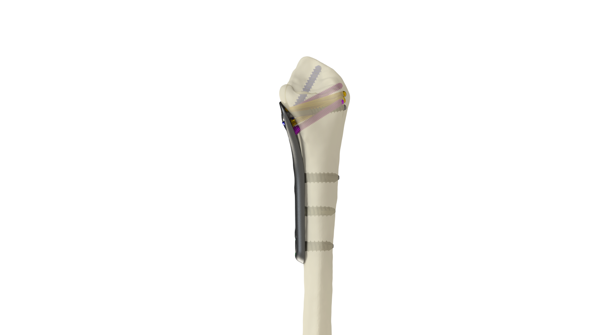 DRPx