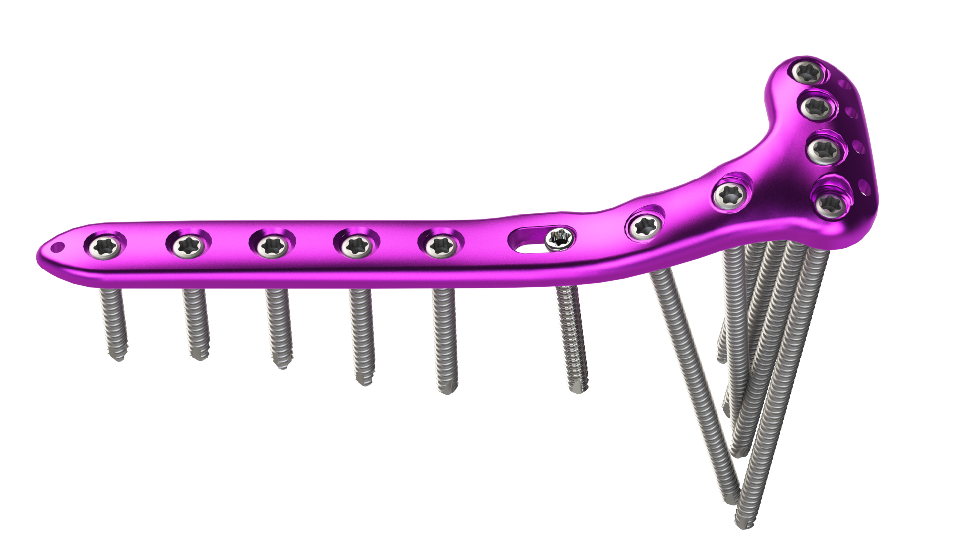 Proximal Tibia Plating System