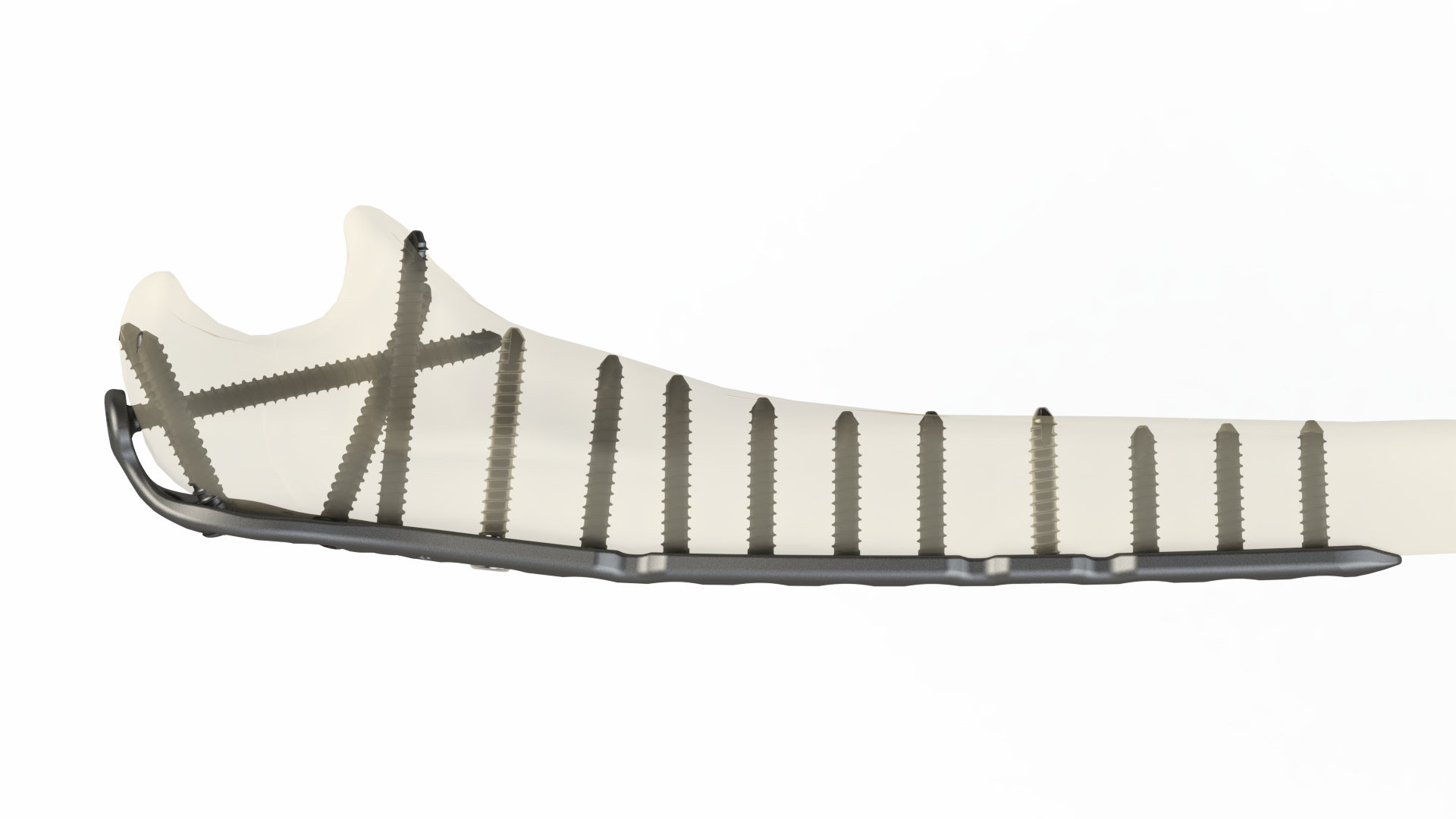 Olecranon