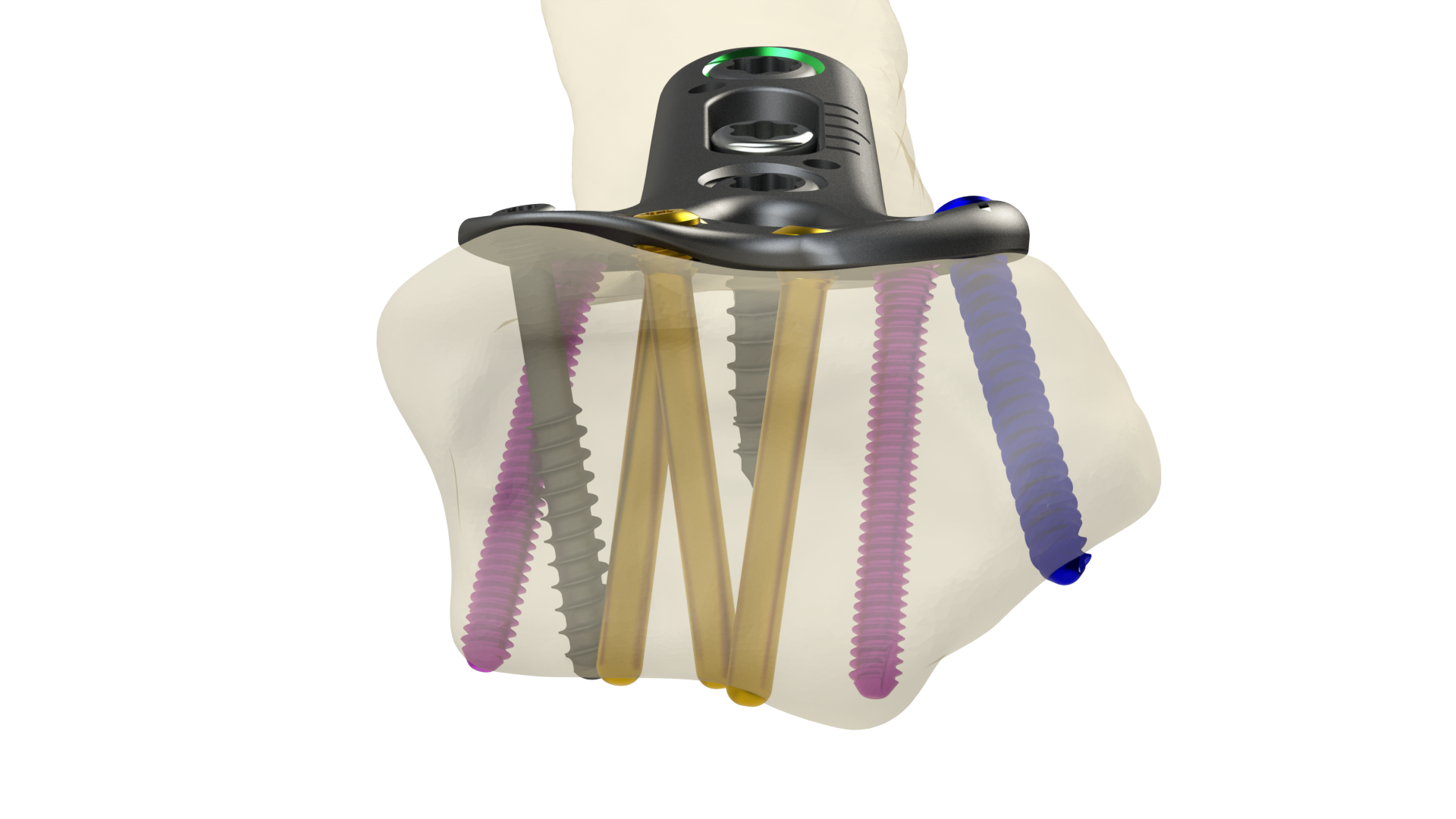 DRPx