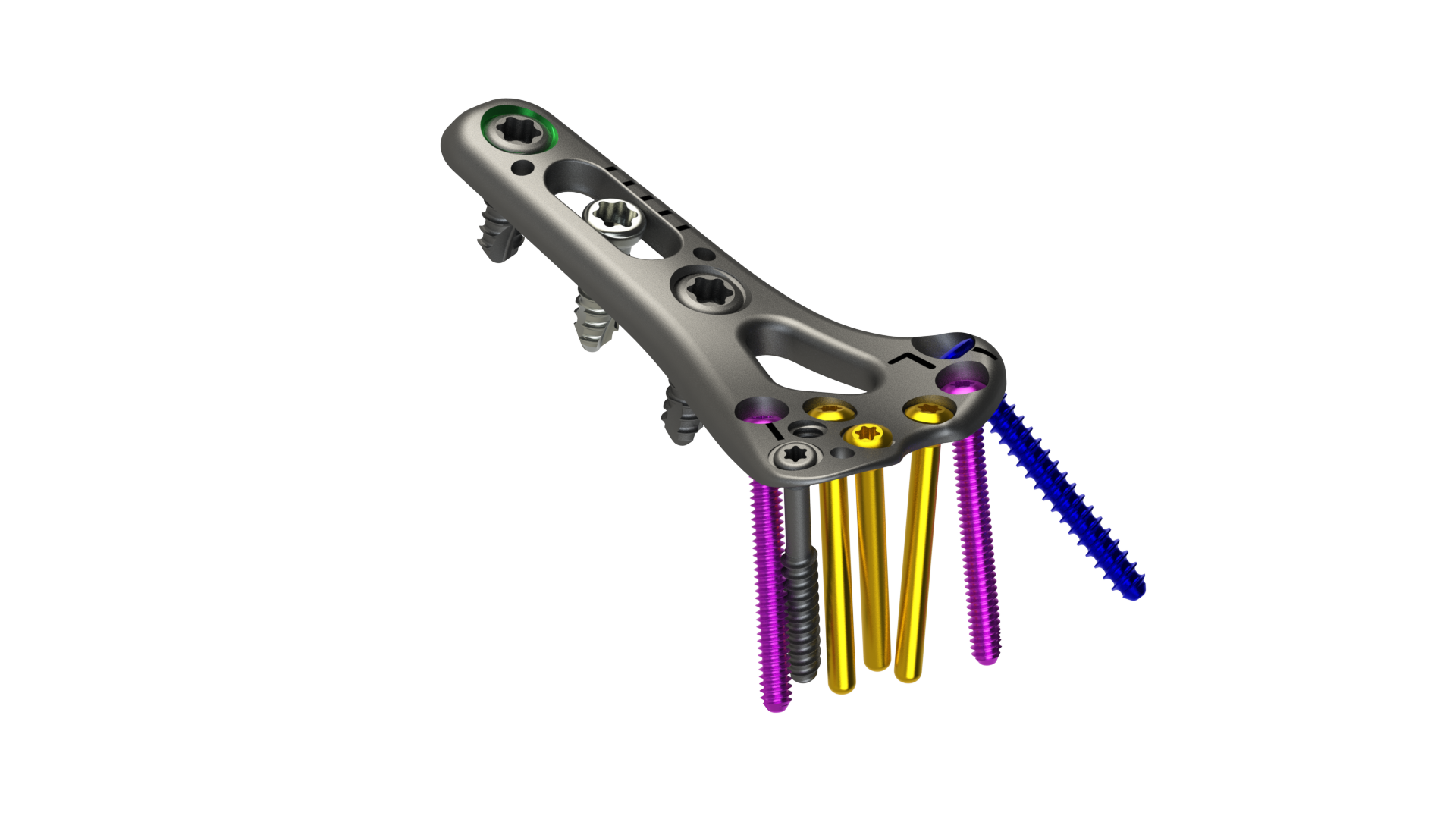 DRPx Distal Radius Plating System
