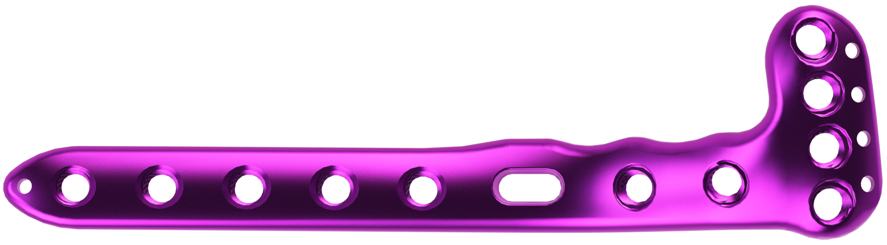 Proximal Tibia