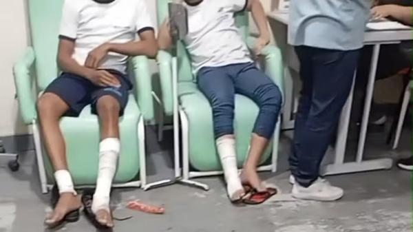 Polícia Civil descarta participação de alunos em explosão que feriu 10 adolescentes em escola de Belford Roxo