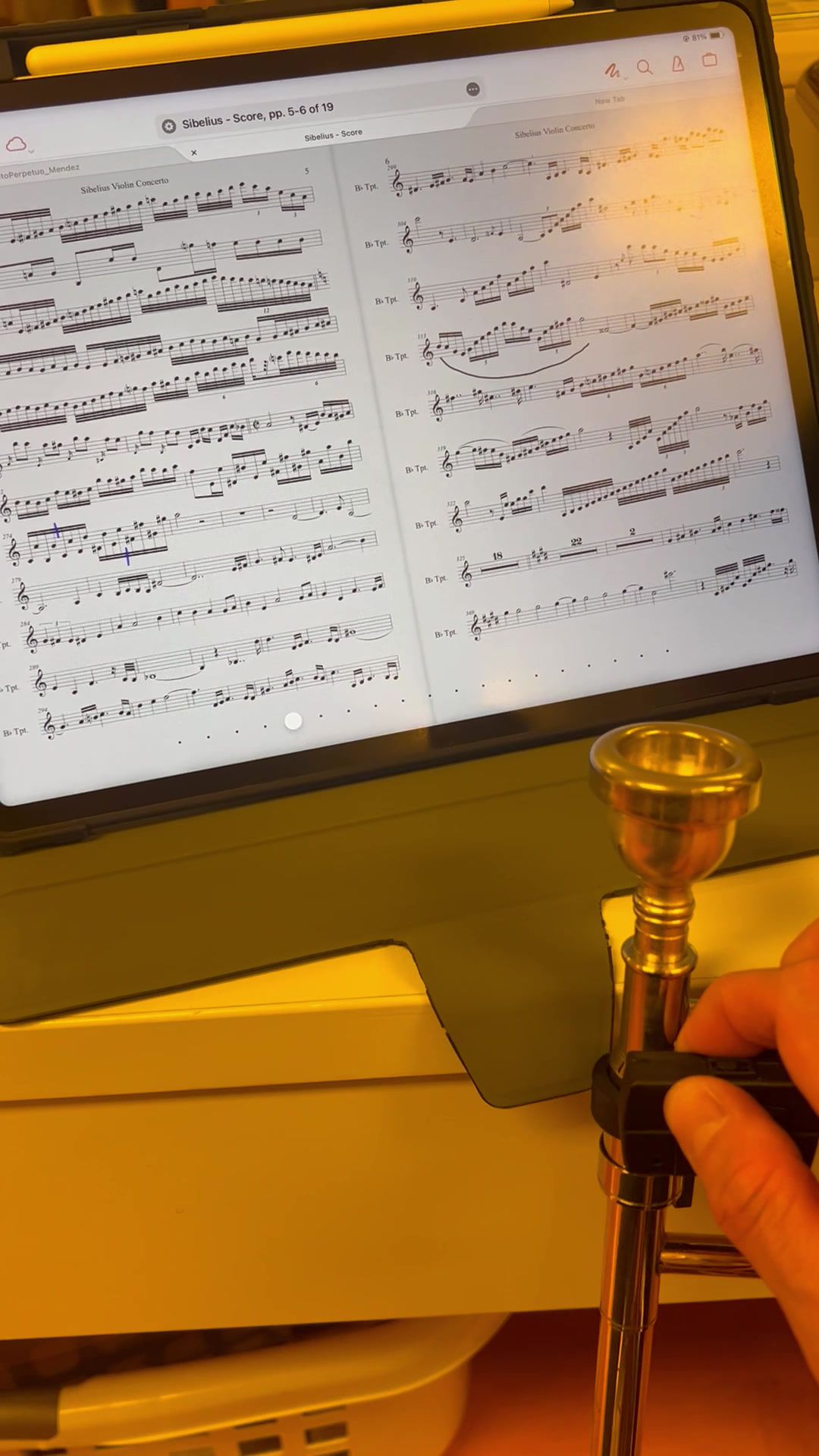 NoteTurner for ForScore view 8