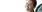 A patient undergoing ant-wrinkle treatment assessment