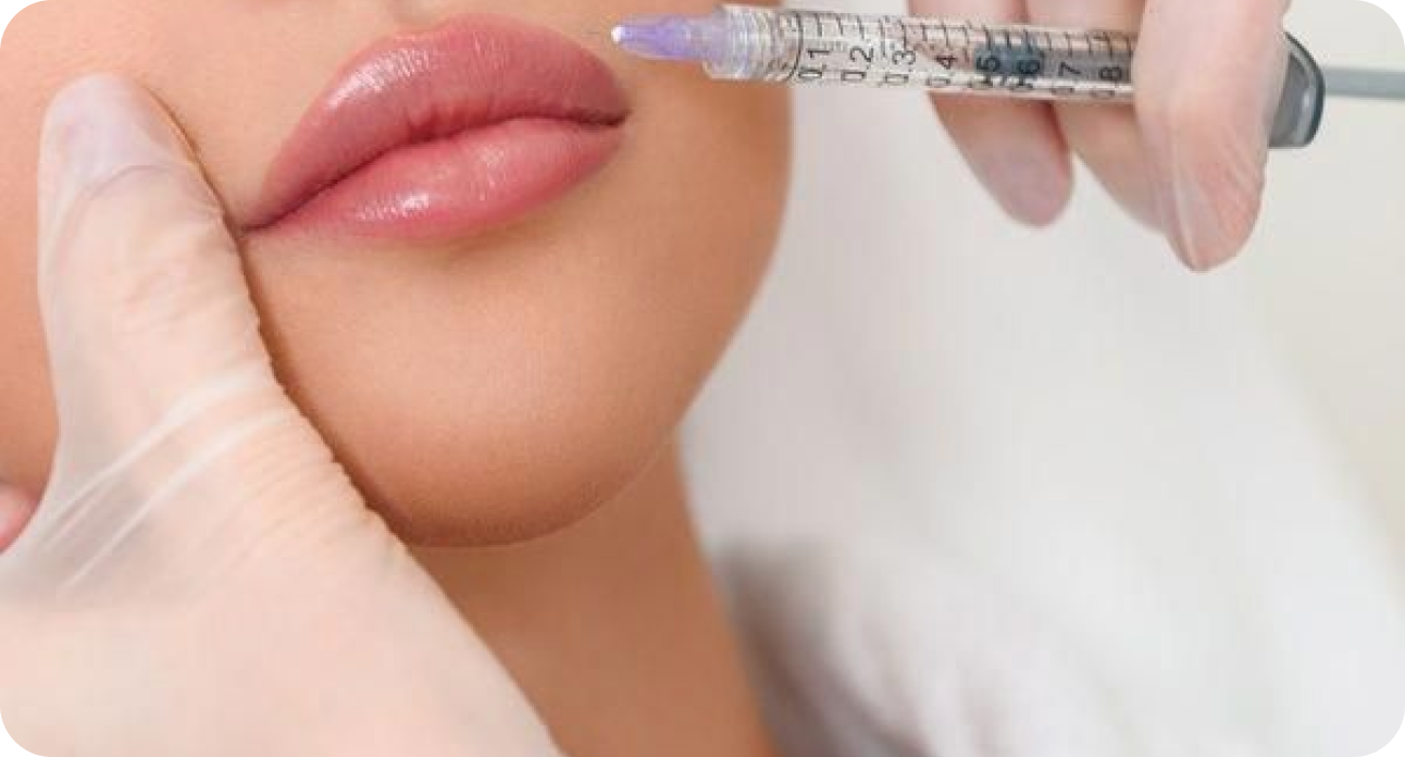 What to expect after lip filler?