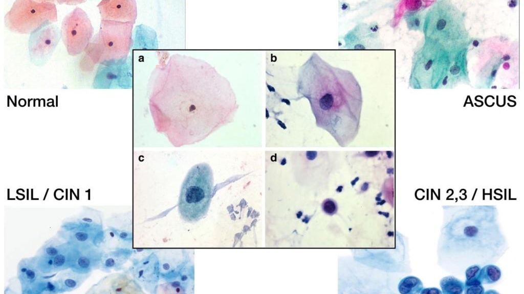 Mascot Medical Pap Smear image