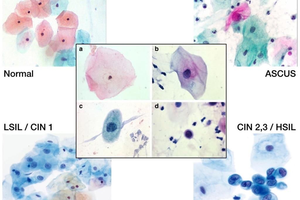 Mascot Medical Pap Smear image