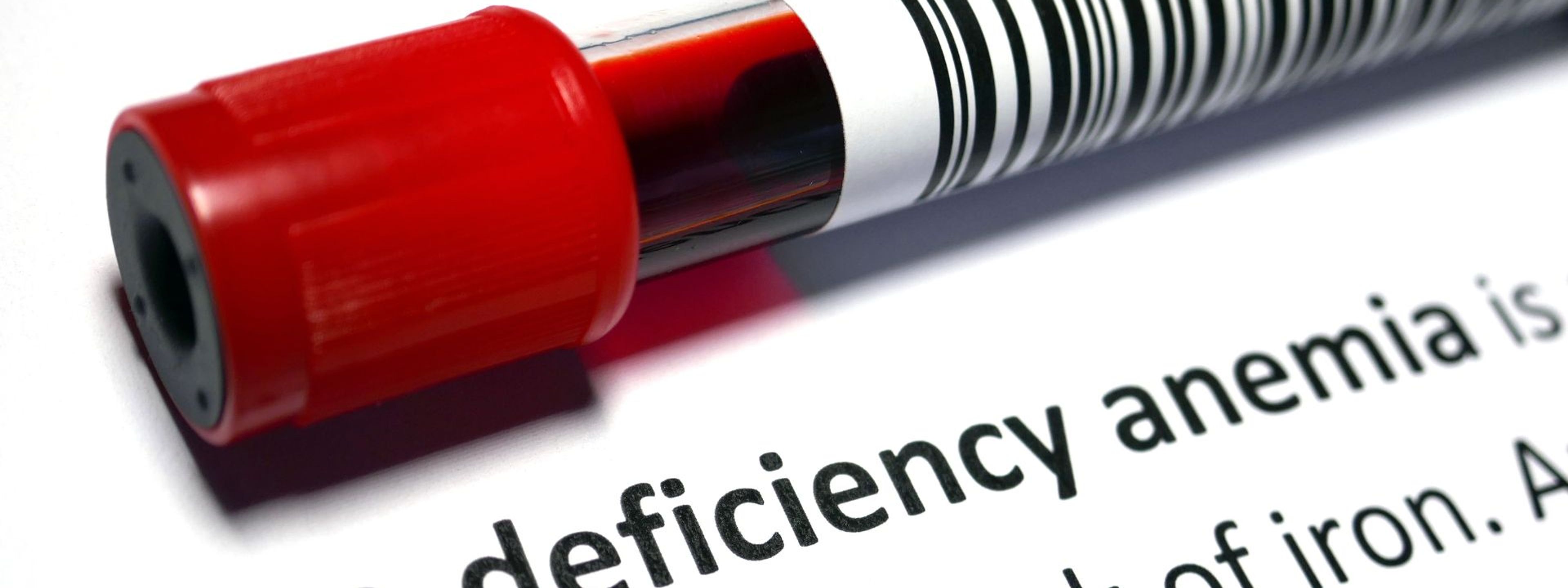 a test tube with a barcode on it is labeled iron deficiency anemia