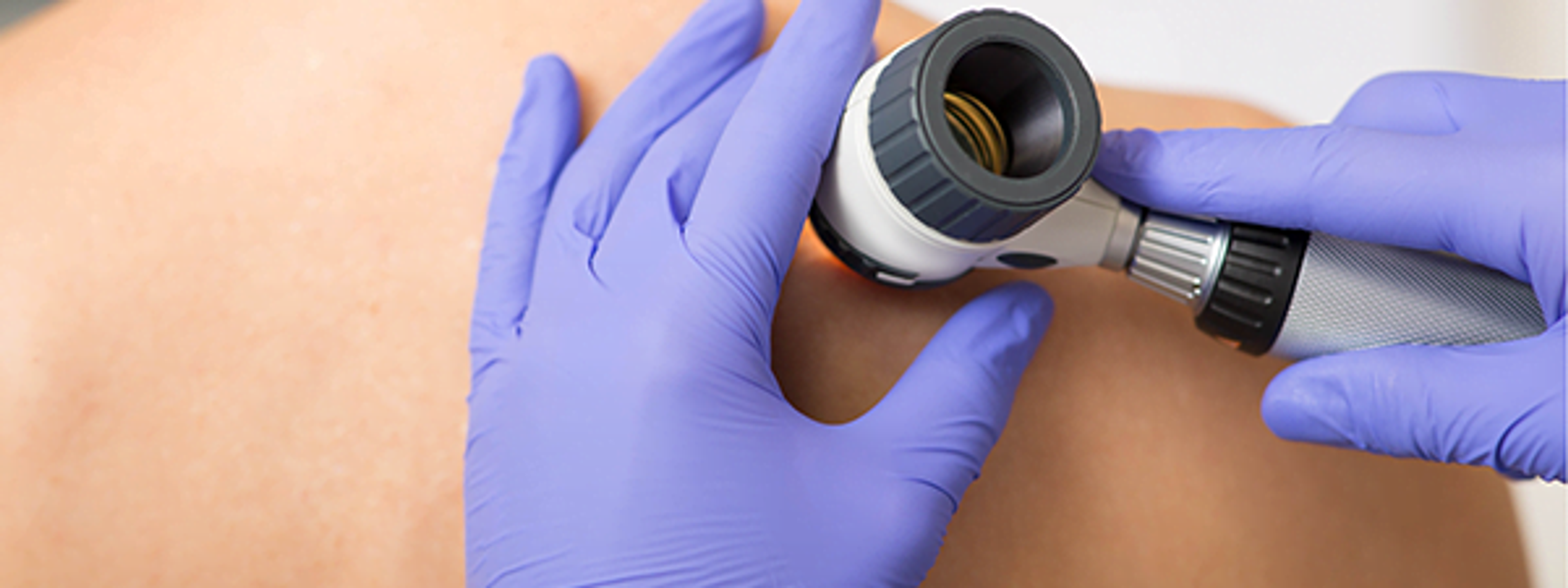 a doctor examines a patient 's back with a magnifying glass