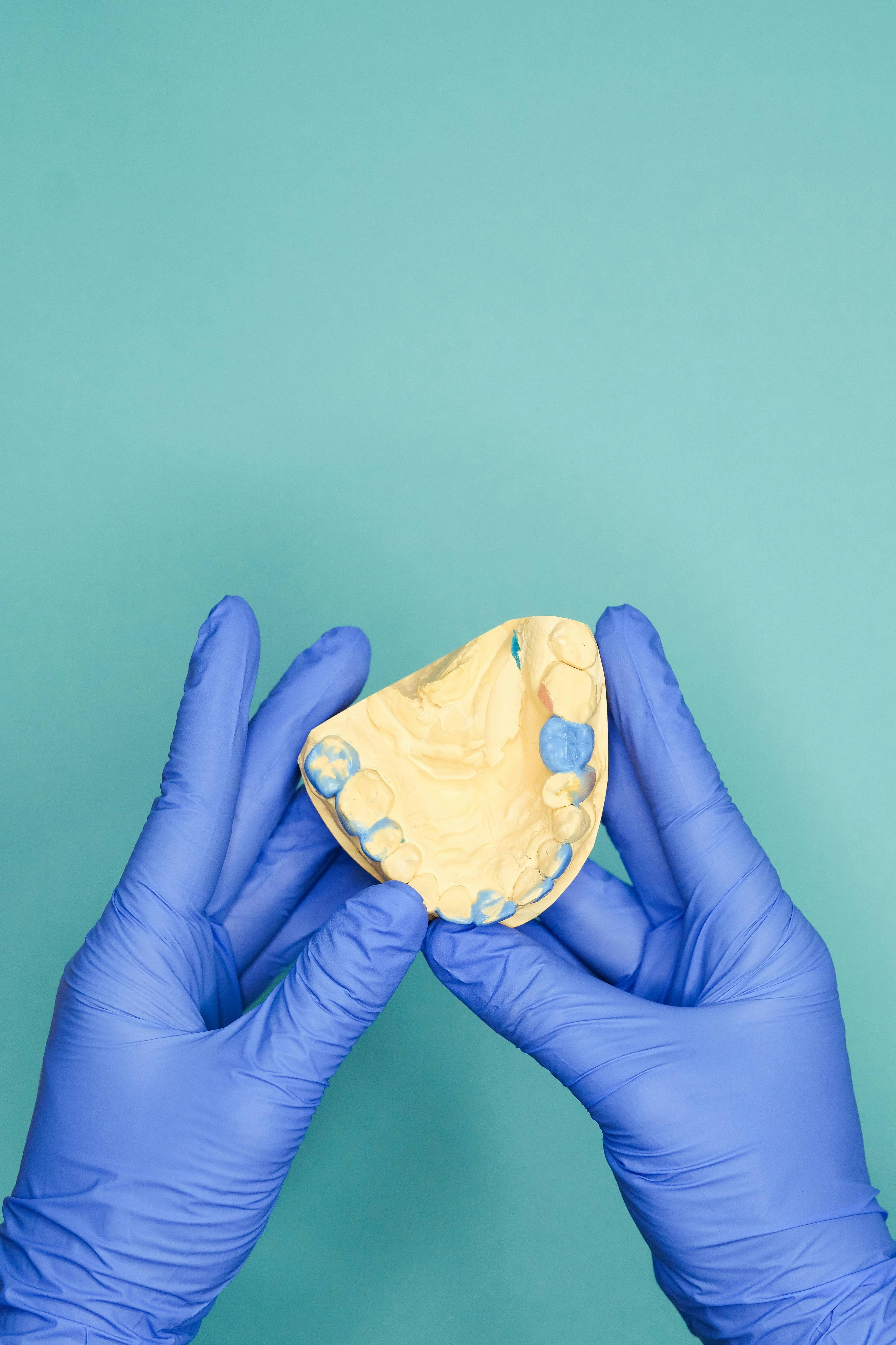 close up of hands wearing blue clinical gloves holding a model of upper teeth with blue areas where restorative treatment is required