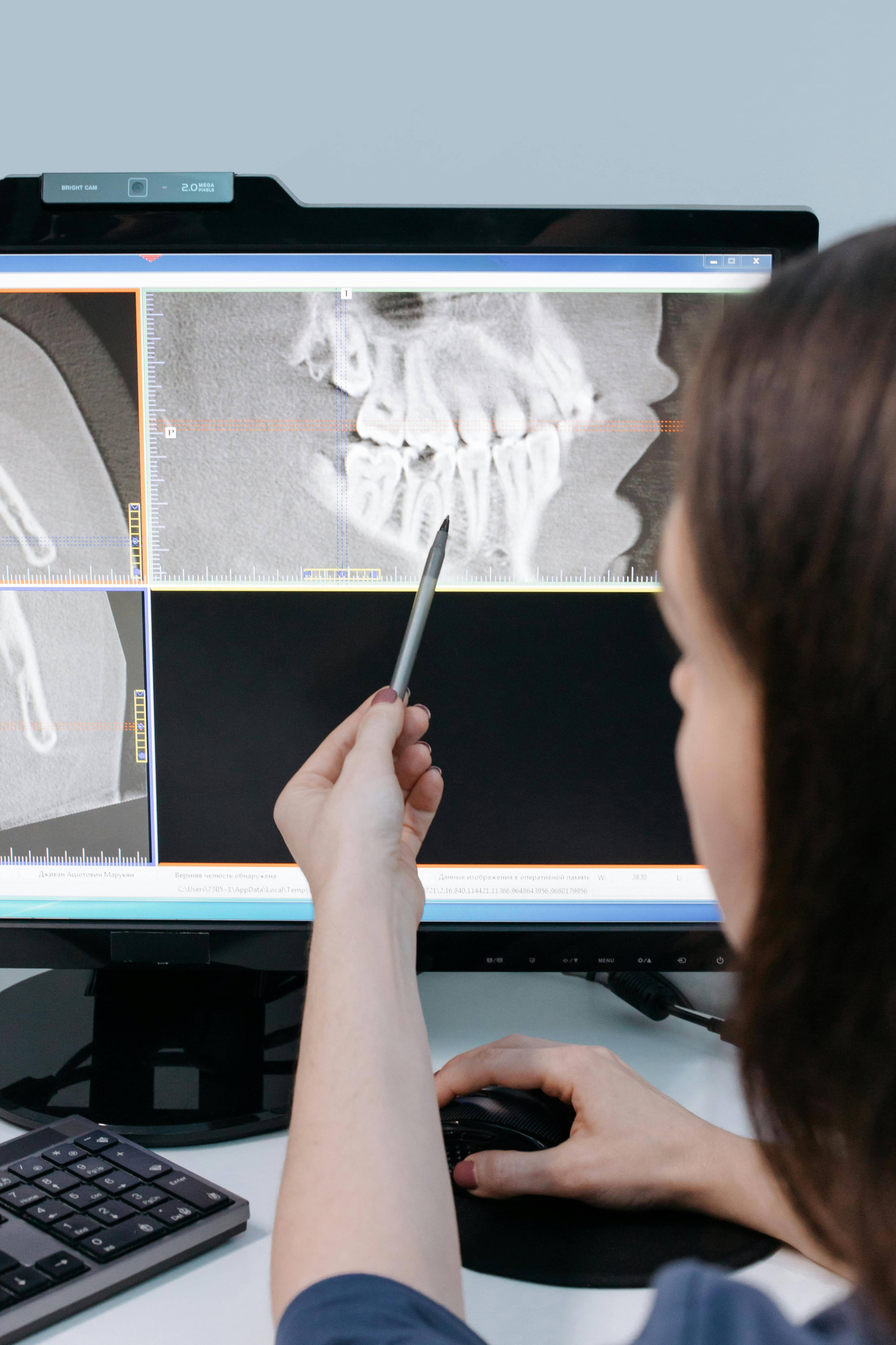 dentist pointing with a pen at a monitor showing patient full jaw x-ray