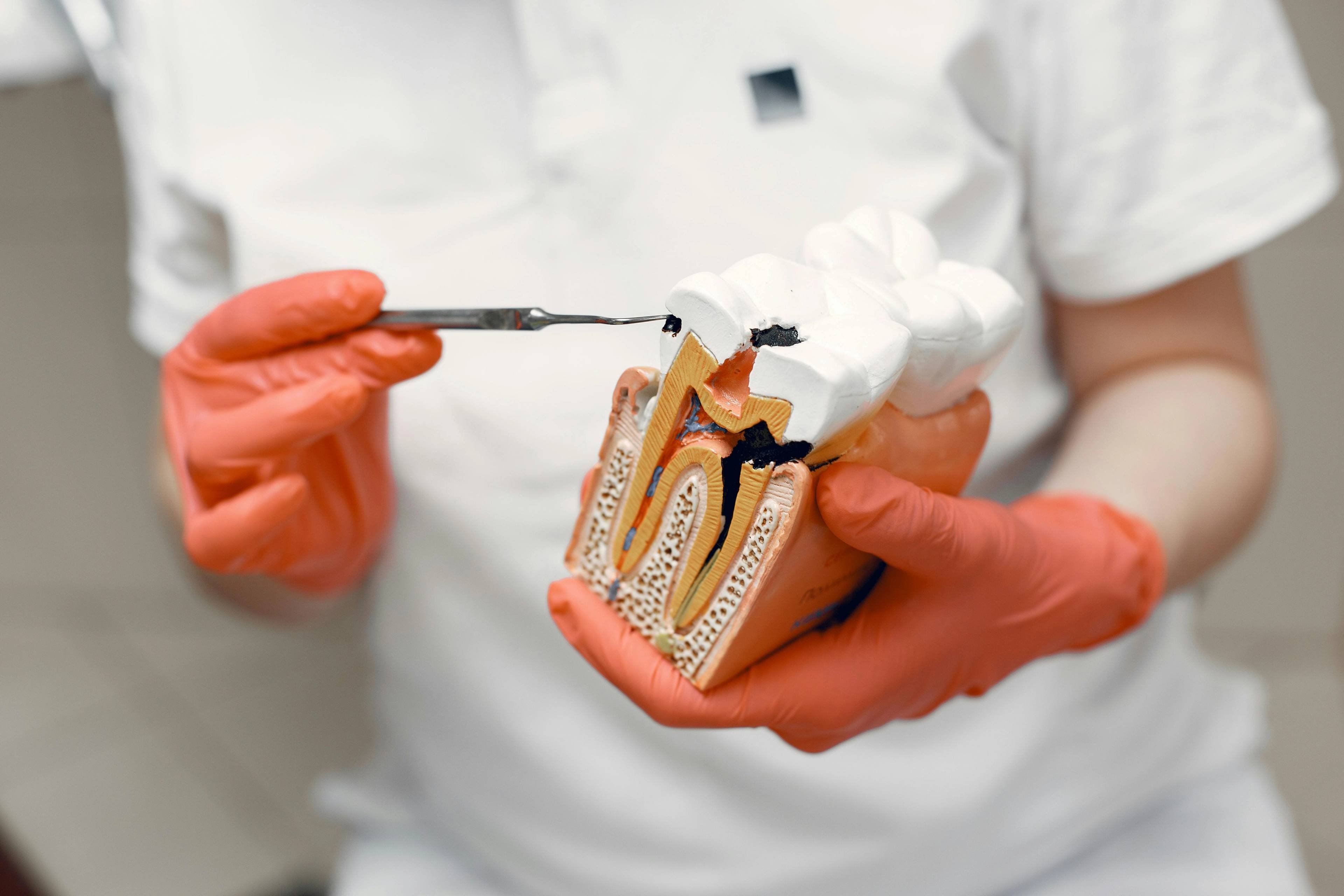 dentist in pink gloves showing tooth decay on model of display teeth