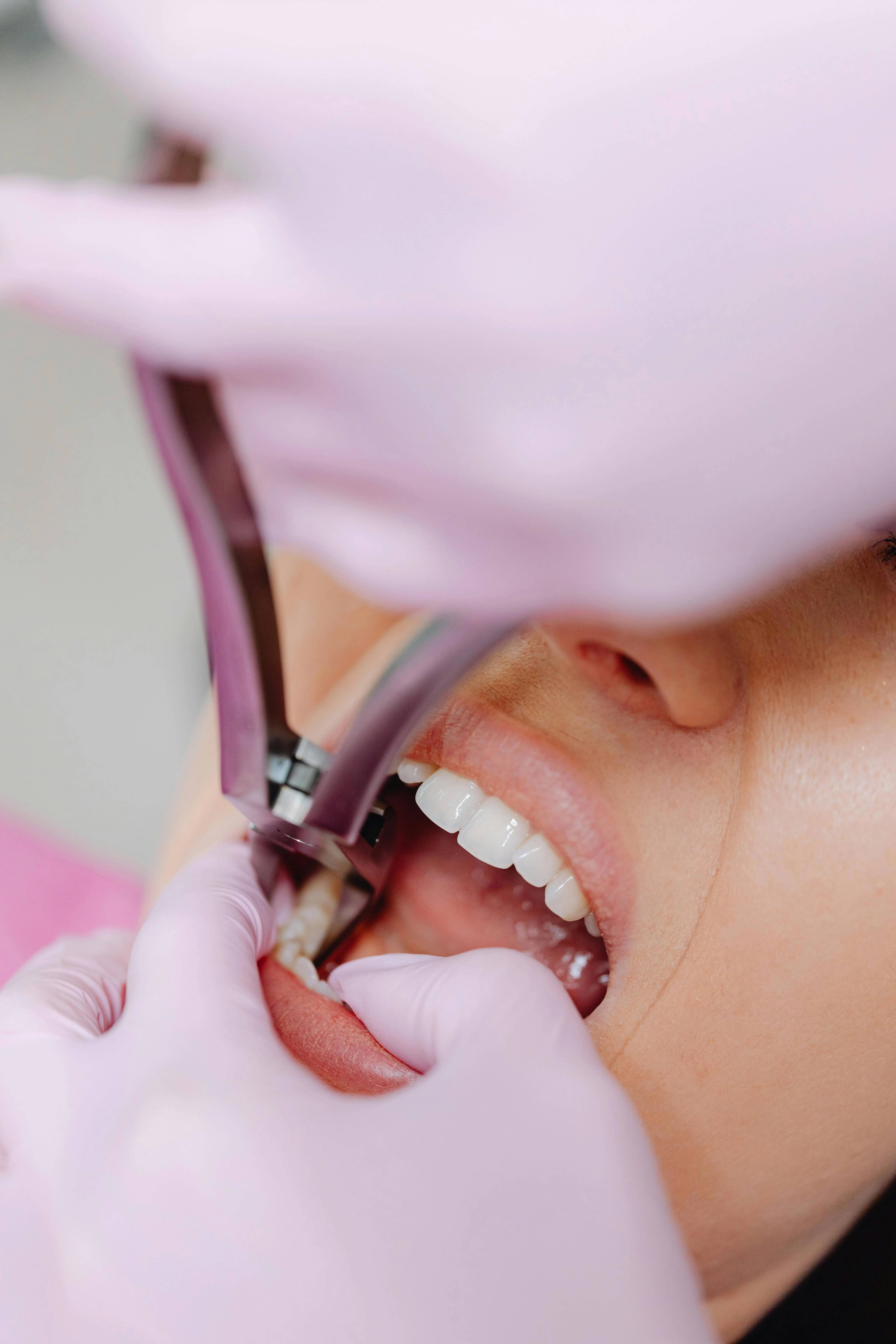 close up of patients mouth having tooth checked while dentist in pink gloves holds tools 