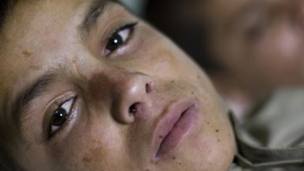 Ni帽os solares: el misterio que desvela a los m茅dicos