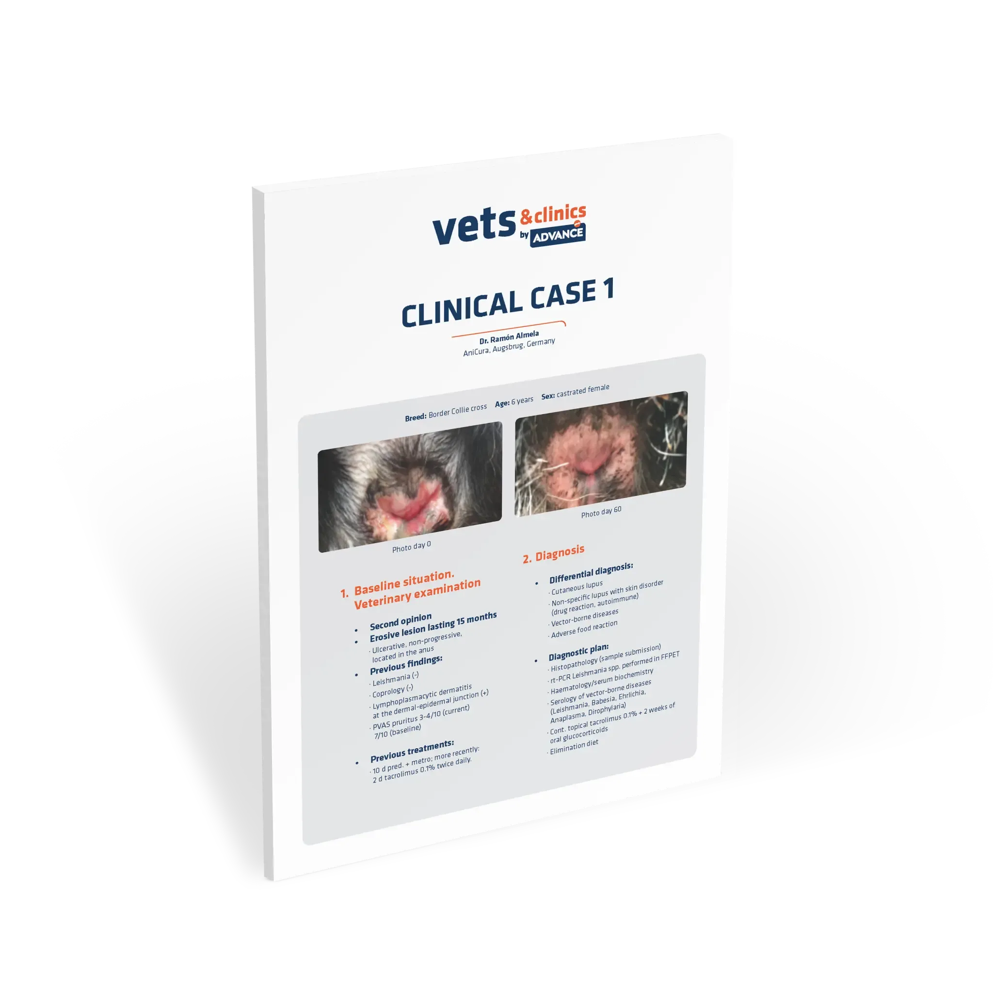 Clinical case: Mucocutaneous Lupus Erythematosus