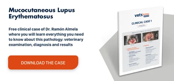 Clinical Case Lupus Clinical Case Lupus