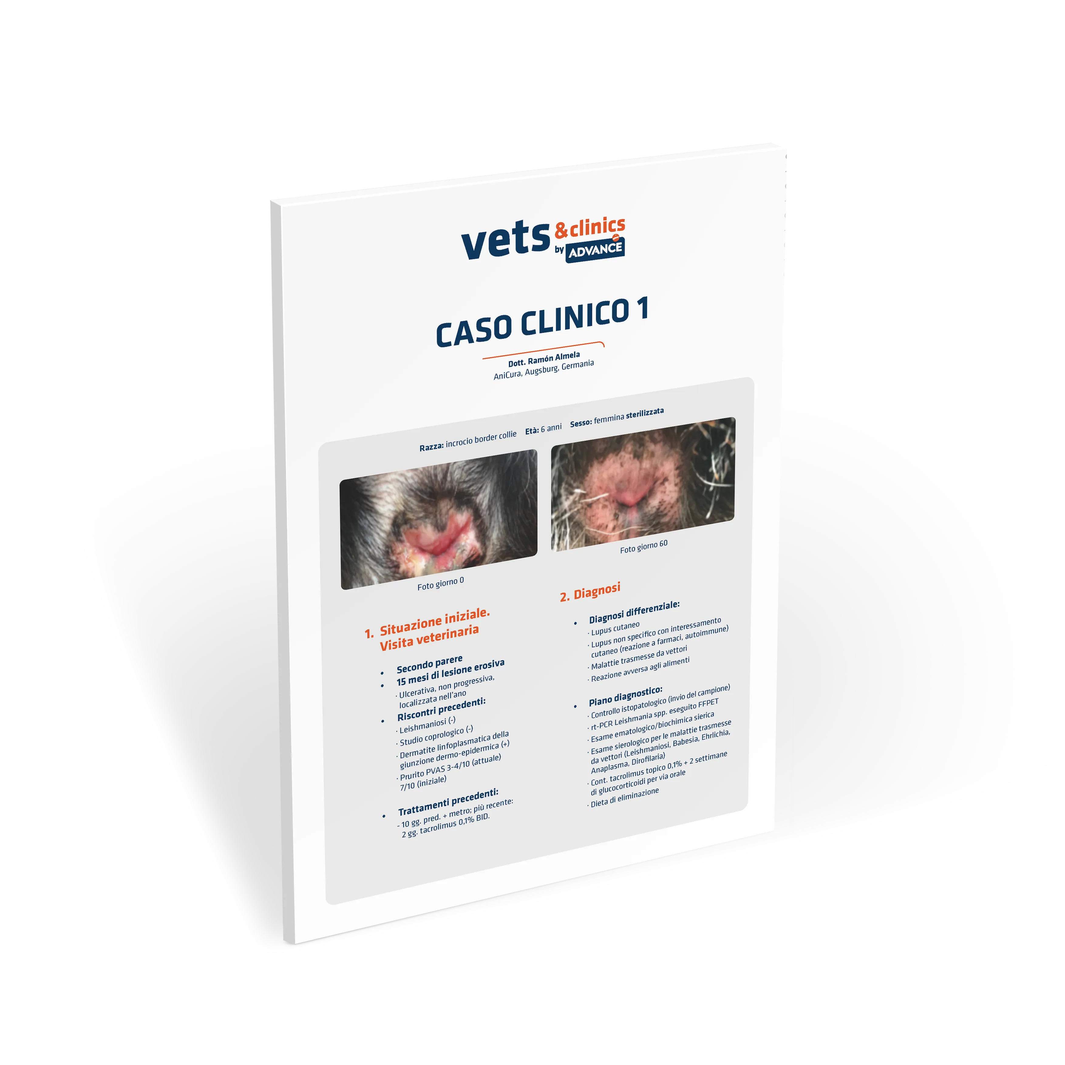 caso-clinico-lupus caso-clinico-lupus