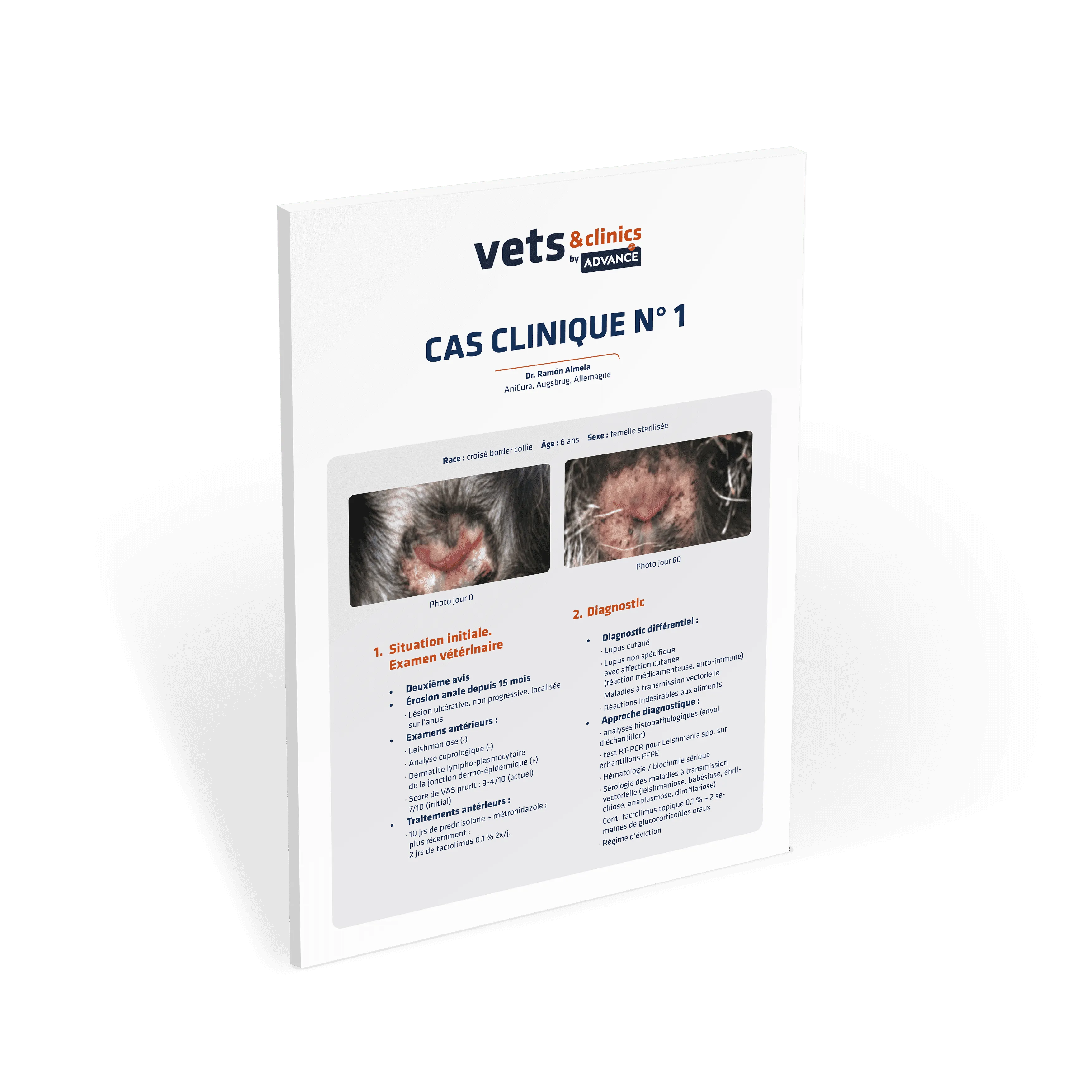 Miniatura Caso Clinico Lupus Miniatura Caso Clinico Lupus