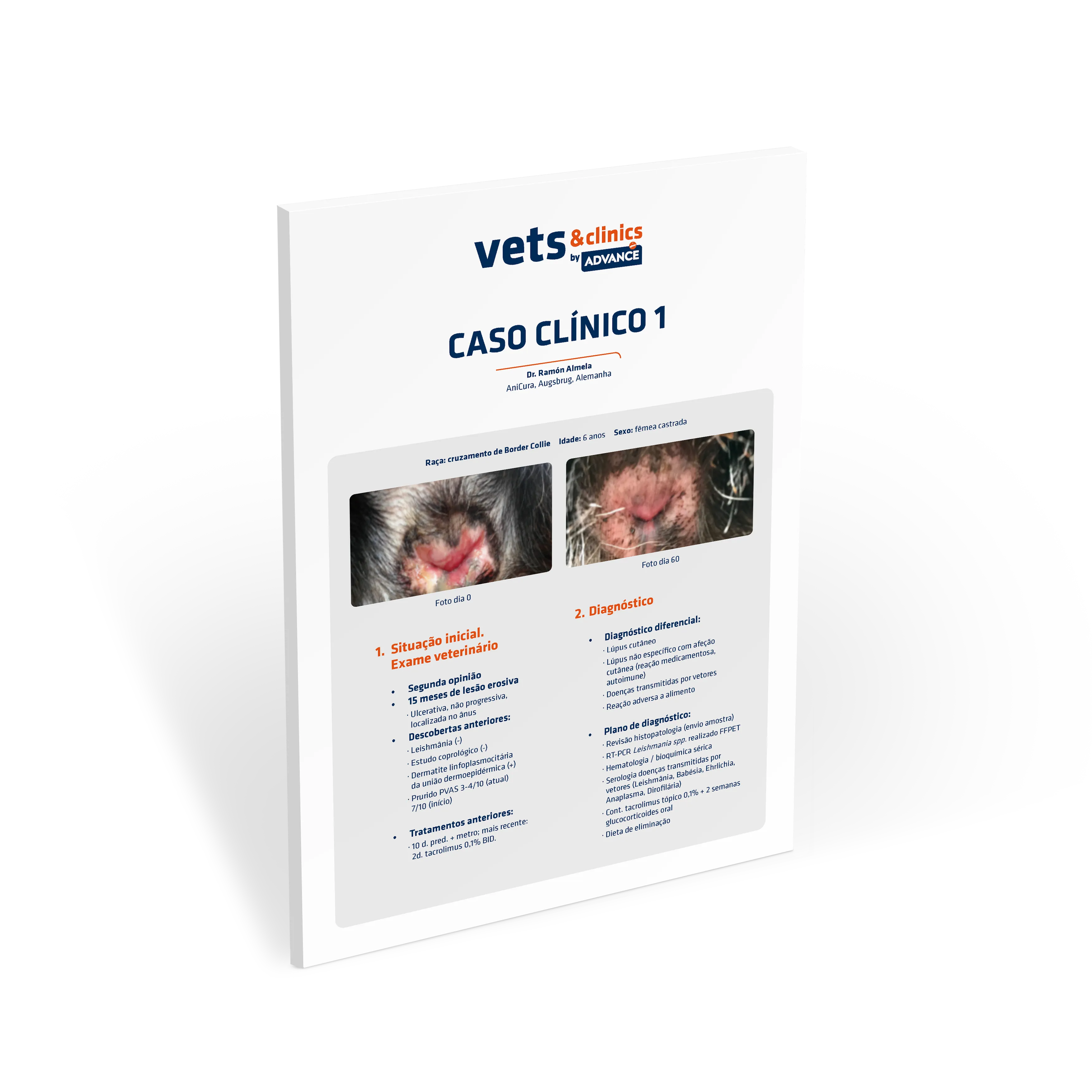 caso-clinico-lupus caso-clinico-lupus