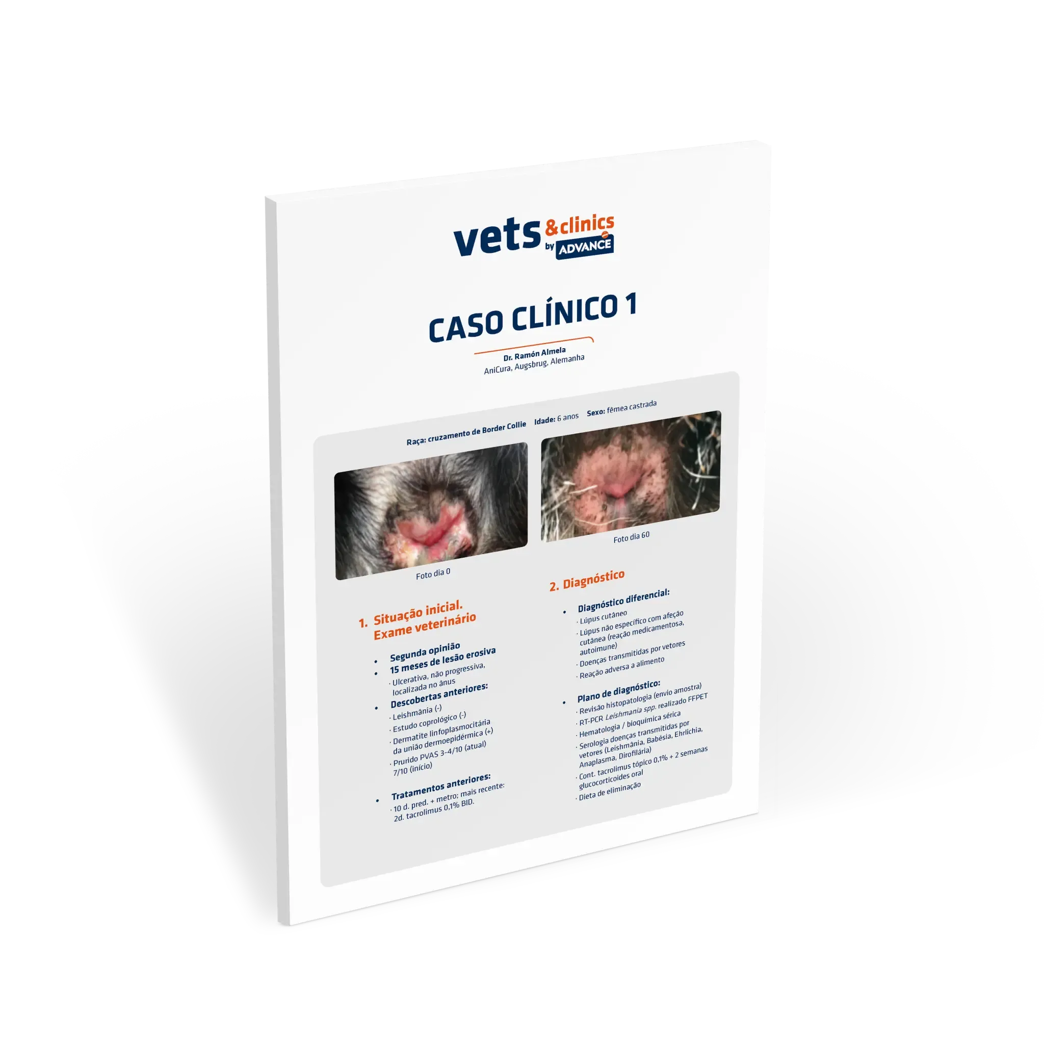 Caso Clínico: Lúpus Eritematoso Mucocutâneo