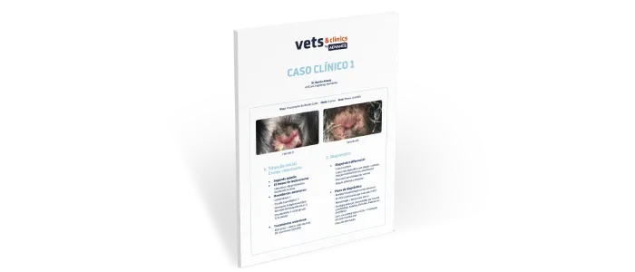 Caso Clínico: Lúpus Eritematoso Mucocutâneo Caso Clínico: Lúpus Eritematoso Mucocutâneo