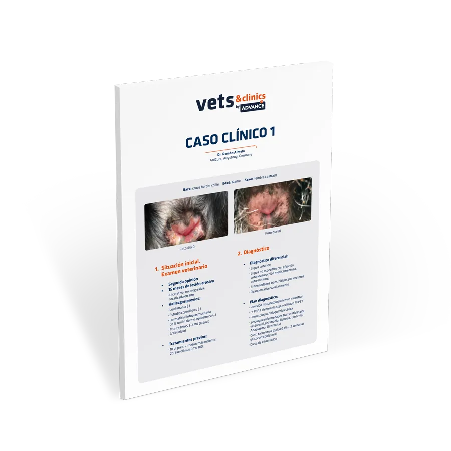 caso-clinico-lupus caso-clinico-lupus